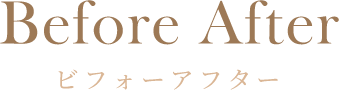 ビフォーアフター